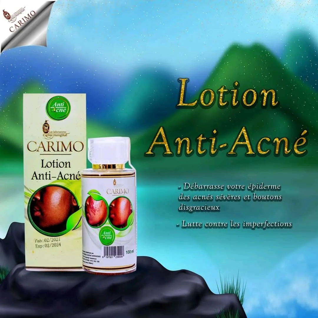 Lotion anti-acné